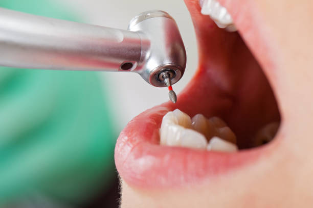 Best Pediatric Emergency Dentist in Parks, AZ